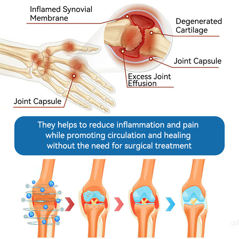 🇬🇧𝐟𝐥𝐲𝐬𝐦𝐮𝐬® 𝐁𝐏𝐂-𝟏𝟓𝟕 𝐉𝐨𝐢𝐧𝐭 𝐇𝐞𝐚𝐥𝐢𝐧𝐠 𝐂𝐫𝐞𝐚𝐦🦴Treats Arthritis, Neuropathy, Rheumatism, Sports Injuries & More🏆