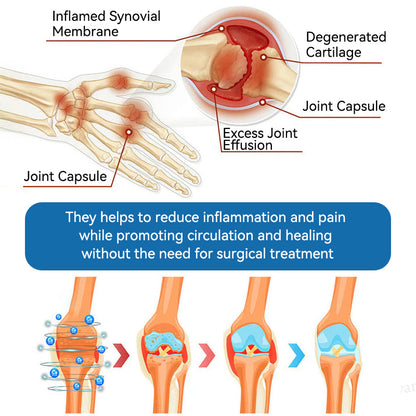 🇬🇧𝐟𝐥𝐲𝐬𝐦𝐮𝐬® 𝐁𝐏𝐂-𝟏𝟓𝟕 𝐉𝐨𝐢𝐧𝐭 𝐇𝐞𝐚𝐥𝐢𝐧𝐠 𝐂𝐫𝐞𝐚𝐦🦴Treats Arthritis, Neuropathy, Rheumatism, Sports Injuries & More🏆