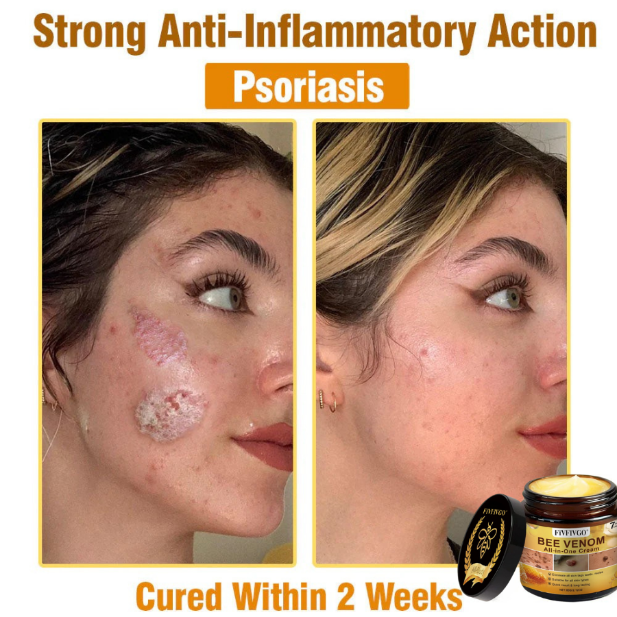 Fivfivgo® Bee Venom All-In-One Cream