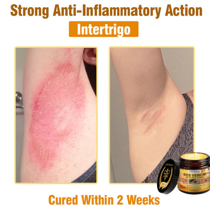 Fivfivgo® Bee Venom All-In-One Cream