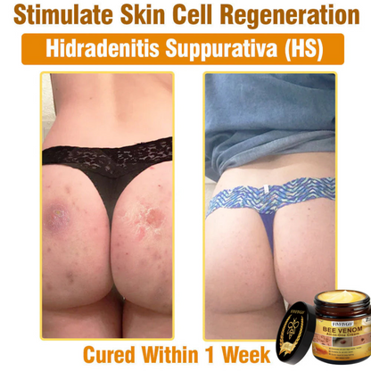 Fivfivgo® Bee Venom All-In-One Cream