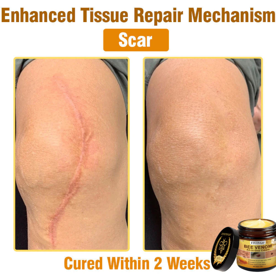 Fivfivgo® Bee Venom All-In-One Cream