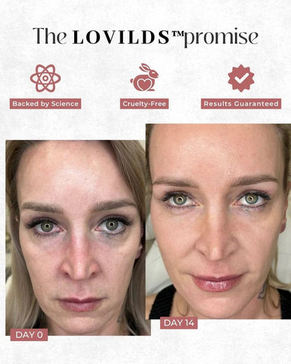 Smoother, Firmer Skin in Minutes – LOVILDS™ Collagen Mask