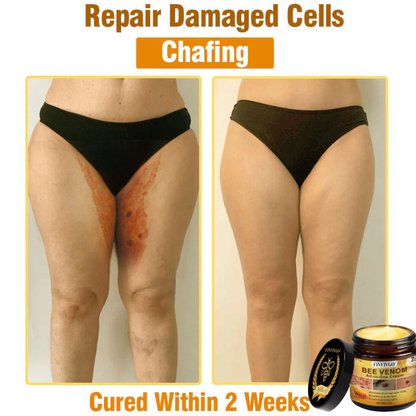 Fivfivgo® Bee Venom All-In-One Cream