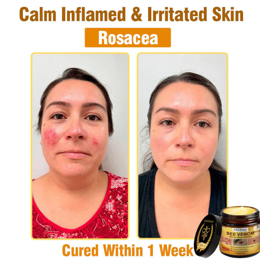 Fivfivgo® Bee Venom All-In-One Cream