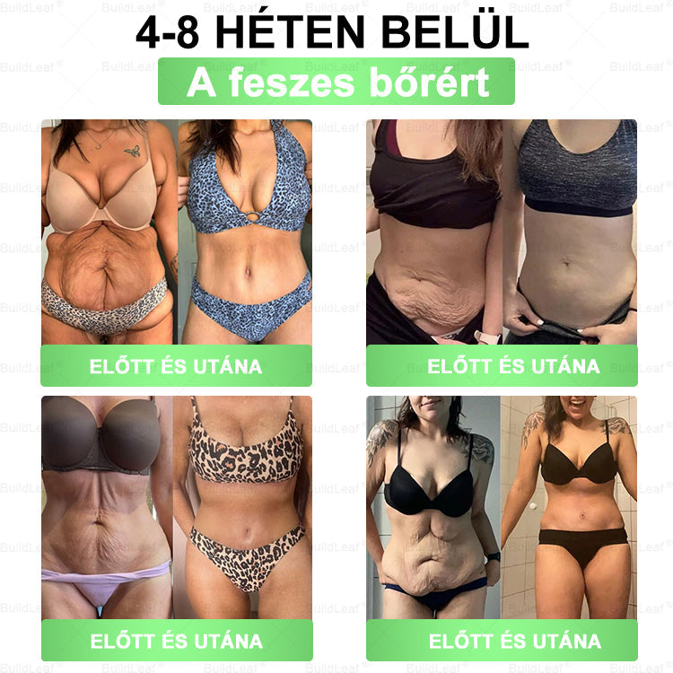 𝐁𝐮𝐢𝐥𝐝𝐋𝐞𝐚𝐟® 𝐆𝐋𝐏-𝟏 𝟖-𝐢𝐧-𝟏 𝐒𝐥𝐢𝐦 & 𝐇𝐞𝐚𝐥𝐭𝐡𝐲 𝐎𝐫á𝐥𝐢𝐬 𝐌𝐞𝐠𝐨𝐥𝐝á𝐬 💚🌿 𝐓á𝐦𝐨𝐠𝐚𝐭𝐣𝐚 𝐚𝐳 𝐞𝐥𝐡í𝐳á𝐬 𝐤𝐞𝐳𝐞𝐥é𝐬é𝐭, 𝐚 𝐬𝐳í𝐯- é𝐬 é𝐫𝐫𝐞𝐧𝐝𝐬𝐳𝐞𝐫𝐢 𝐞𝐠é𝐬𝐳𝐬é𝐠𝐞𝐭, 𝐚 𝐜𝐮𝐤𝐨𝐫𝐛𝐞𝐭𝐞𝐠𝐬é𝐠𝐞𝐭, 𝐚𝐳 𝐚𝐥𝐯á𝐬𝐢 𝐚𝐩𝐧𝐨é𝐭, 𝐚 𝐛é𝐥𝐫𝐞𝐧𝐝𝐬𝐳𝐞𝐫 𝐞𝐠é𝐬𝐳𝐬é𝐠é𝐭, 𝐦𝐢𝐤ö𝐳𝐛𝐞𝐧 𝐟𝐞𝐬𝐳𝐞𝐬í𝐭𝐢 𝐚 𝐛ő𝐫𝐭 is𝐬𝐧ö𝐯𝐞𝐥𝐢 𝐚𝐳 𝐞𝐧𝐞𝐫𝐠𝐢á𝐭.✅