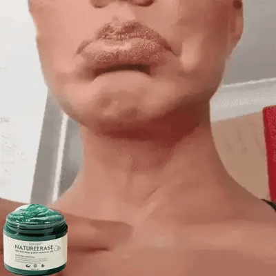 LOVILDS™ NatureErase Instant Mole & Spot Removal Gel