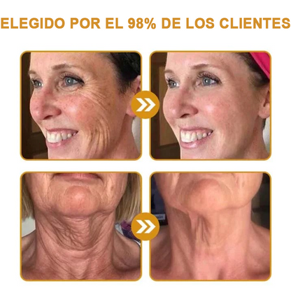 🍀ÚLTIMO DÍA 80% DE DESCUENTO✨𝐅𝐮𝐫𝐳𝐞𝐫𝐨™  Botox Crema antiarrugas con veneno de abeja 🐝