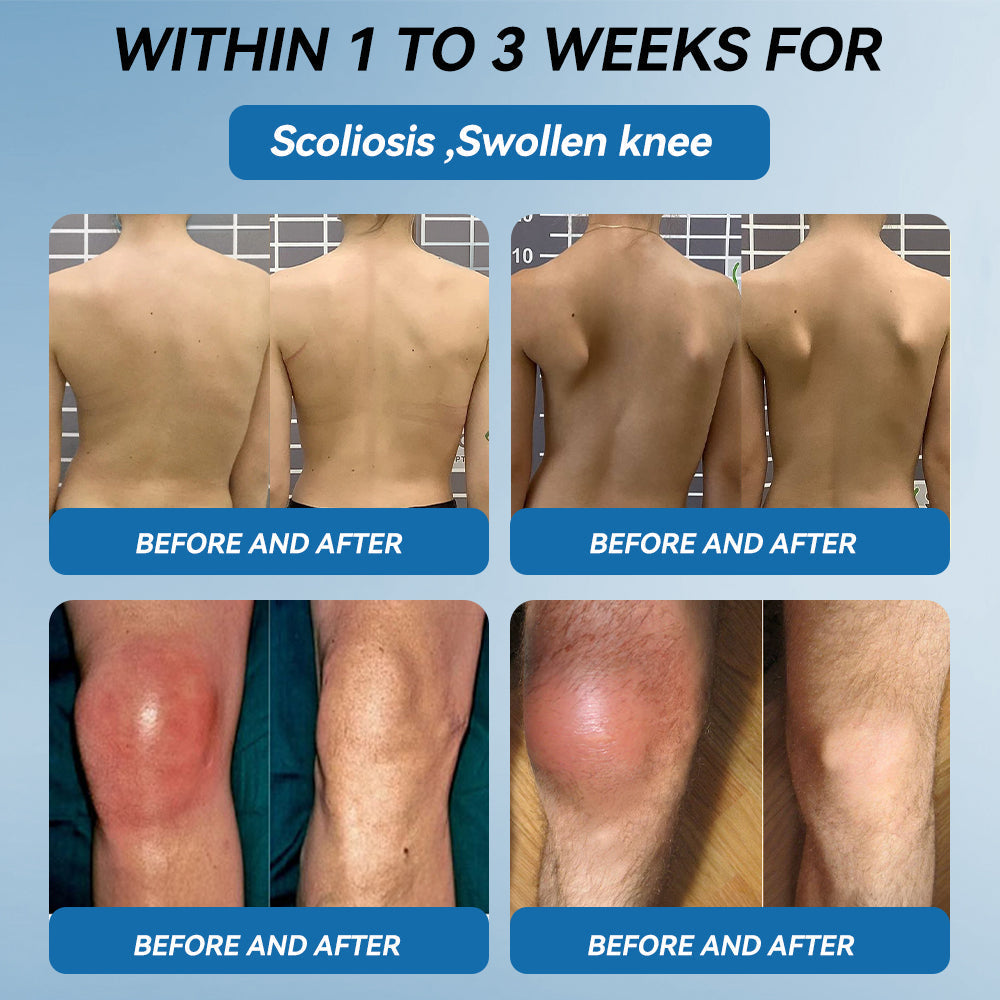 🇬🇧𝐟𝐥𝐲𝐬𝐦𝐮𝐬® 𝐁𝐏𝐂-𝟏𝟓𝟕 𝐉𝐨𝐢𝐧𝐭 𝐇𝐞𝐚𝐥𝐢𝐧𝐠 𝐂𝐫𝐞𝐚𝐦🦴Treats Arthritis, Neuropathy, Rheumatism, Sports Injuries & More🏆