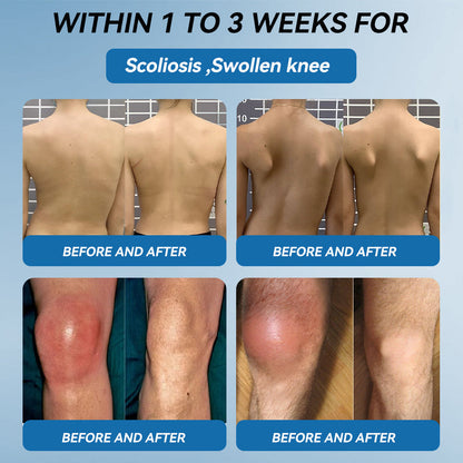 🇬🇧𝐟𝐥𝐲𝐬𝐦𝐮𝐬® 𝐁𝐏𝐂-𝟏𝟓𝟕 𝐉𝐨𝐢𝐧𝐭 𝐇𝐞𝐚𝐥𝐢𝐧𝐠 𝐂𝐫𝐞𝐚𝐦🦴Treats Arthritis, Neuropathy, Rheumatism, Sports Injuries & More🏆