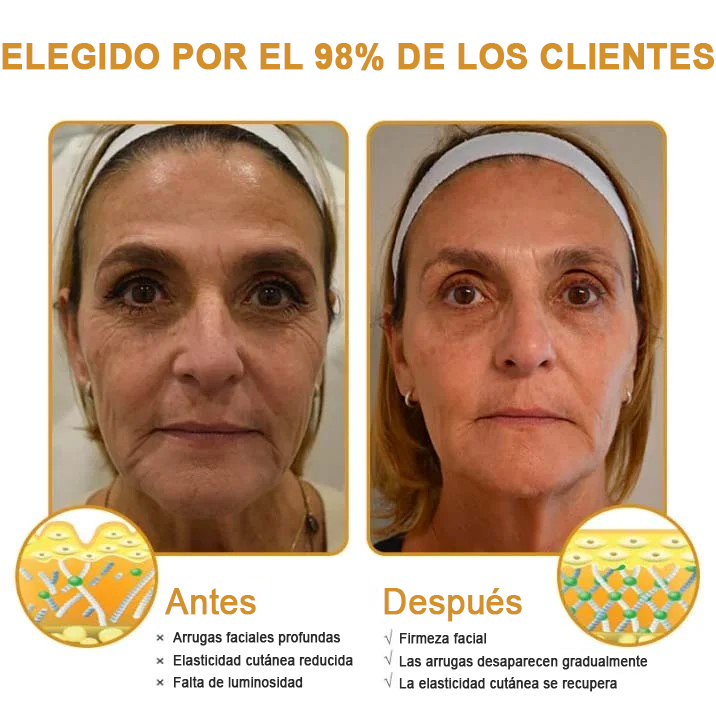 🍀ÚLTIMO DÍA 80% DE DESCUENTO✨𝐅𝐮𝐫𝐳𝐞𝐫𝐨™  Botox Crema antiarrugas con veneno de abeja 🐝