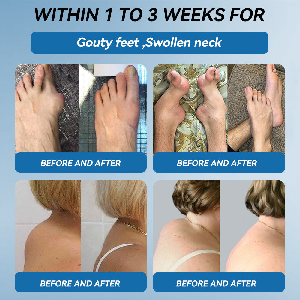 🇬🇧𝐟𝐥𝐲𝐬𝐦𝐮𝐬® 𝐁𝐏𝐂-𝟏𝟓𝟕 𝐉𝐨𝐢𝐧𝐭 𝐇𝐞𝐚𝐥𝐢𝐧𝐠 𝐂𝐫𝐞𝐚𝐦🦴Treats Arthritis, Neuropathy, Rheumatism, Sports Injuries & More🏆