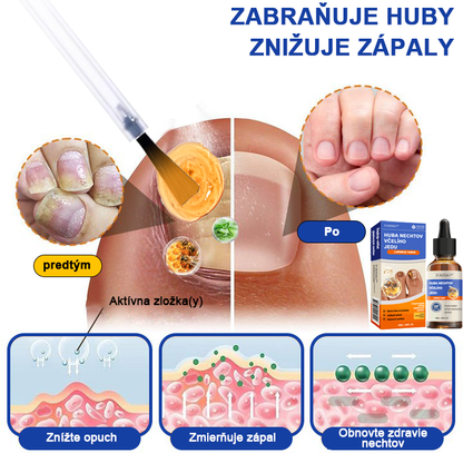 🐝Furzero™ Včelí jed na plesne na nechtoch: kompletné riešenie plesní na nechtoch 🌟👣👣👣