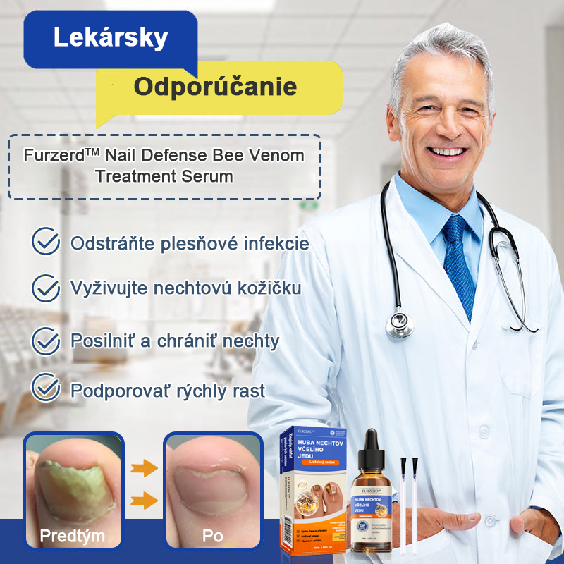 🐝Furzero™ Včelí jed na plesne na nechtoch: kompletné riešenie plesní na nechtoch 🌟👣👣👣