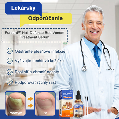 🐝Furzero™ Včelí jed na plesne na nechtoch: kompletné riešenie plesní na nechtoch 🌟👣👣👣