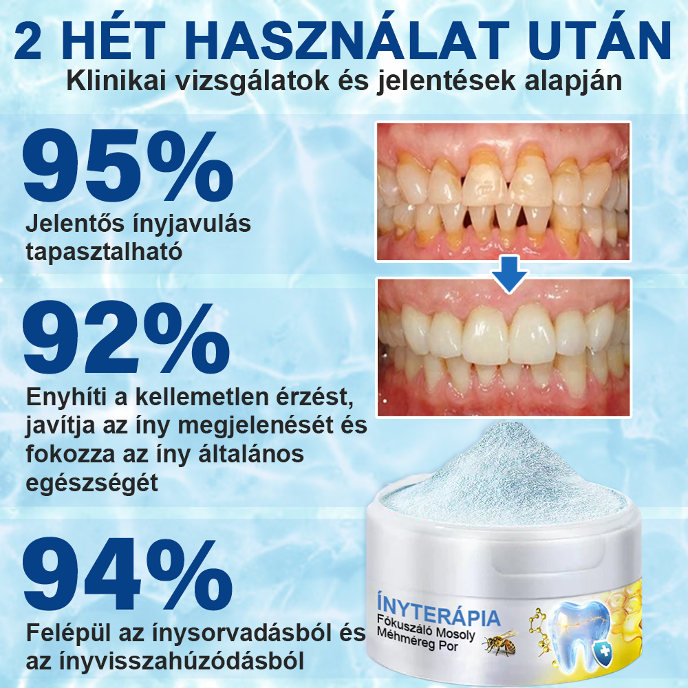 🇭🇺 Furzero® 𝑭𝒐𝒄𝒖𝒔𝒔𝒎𝒊𝒍𝒆 – Méhméreges szájápoló por 🦷🦷