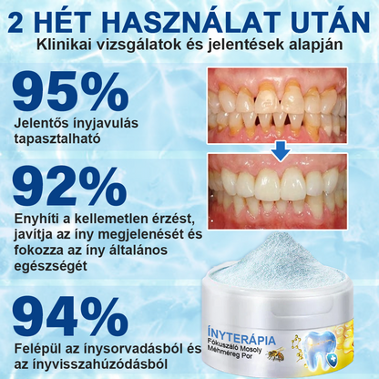 🇭🇺 Furzero® 𝑭𝒐𝒄𝒖𝒔𝒔𝒎𝒊𝒍𝒆 – Méhméreges szájápoló por 🦷🦷