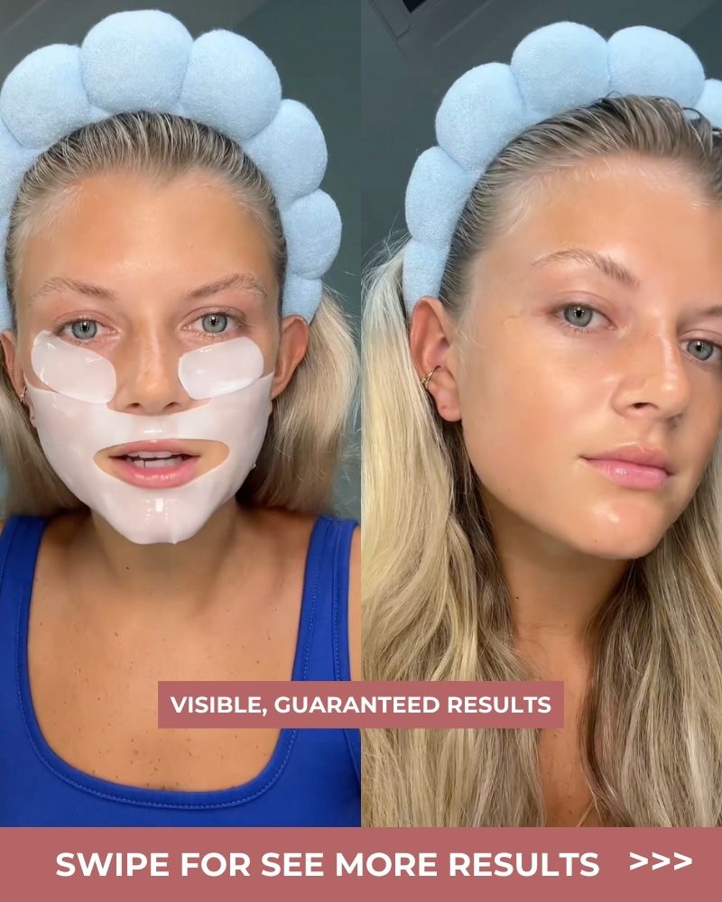Smoother, Firmer Skin in Minutes – LOVILDS™ Collagen Mask
