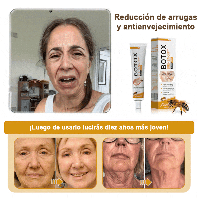 🍀ÚLTIMO DÍA 80% DE DESCUENTO✨𝐅𝐮𝐫𝐳𝐞𝐫𝐨™  Botox Crema antiarrugas con veneno de abeja 🐝