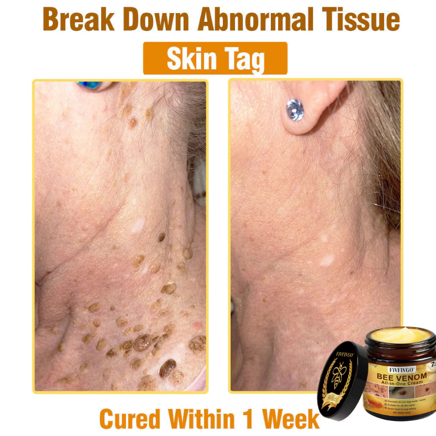 Fivfivgo® Bee Venom All-In-One Cream