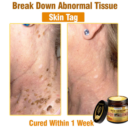Fivfivgo® Bee Venom All-In-One Cream