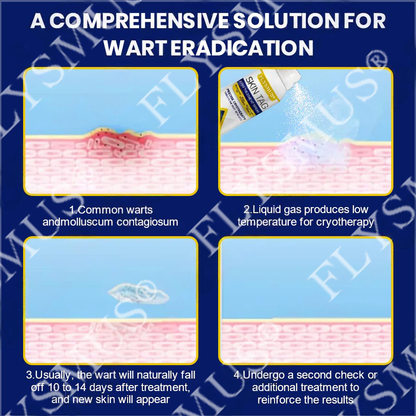 FLYSMUS® SKIN TAG CRYO TREATMENT SPRAY ACE