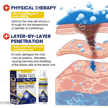 FLYSMUS® SKIN TAG CRYO TREATMENT SPRAY ACE
