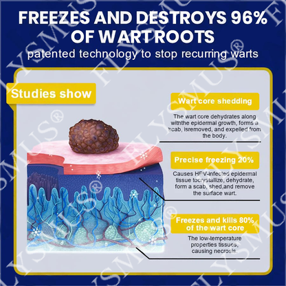 FLYSMUS® SKIN TAG CRYO TREATMENT SPRAY ACE