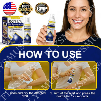 FLYSMUS® SKIN TAG CRYO TREATMENT SPRAY ACE