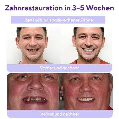 Fivfivgo® Zahnrestauration Mineralisches Puder